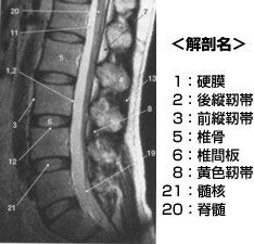 図1:腰椎の正常解剖