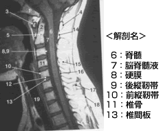 図1:頚の解剖（矢状面）